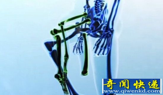 菲律宾惊现长5条腿畸形人 疑似外星人产物