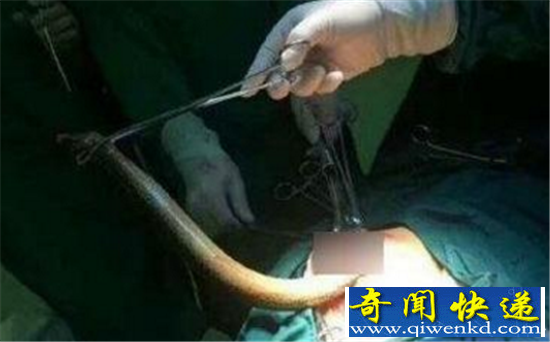 黄鳝门女主播被抓 冯提莫吃精门事件被挖粉丝打赏百万入狱