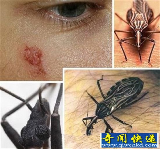 十大吸血鬼!吸血鲶鱼可钻入人体