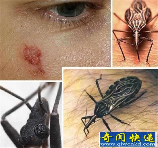 盘点:生物界十大吸血动物 吸血蝙蝠排在末位