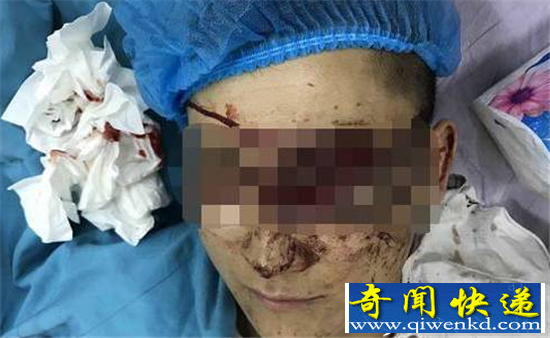 女司机被12保安暴打恐失明