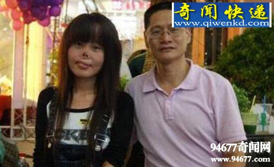 无鼻女3岁被老鼠咬掉鼻子,整形后蜕变准新娘