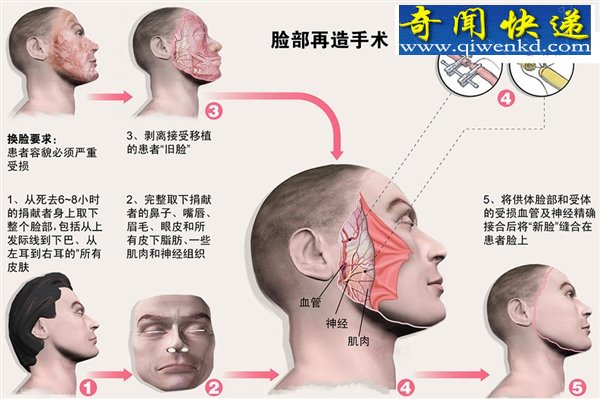 换脸是种什么感觉 恐怖的脸部移植手术