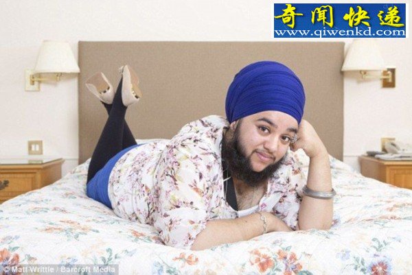 英国23岁女子长满脸络腮胡