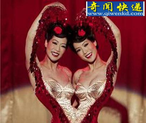 两人一个身体的恐怖变异连体人(组图)