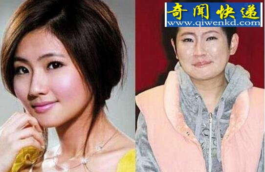 任家萱烧伤图片曝光,疤痕太吓人(惨遭老公抛弃)