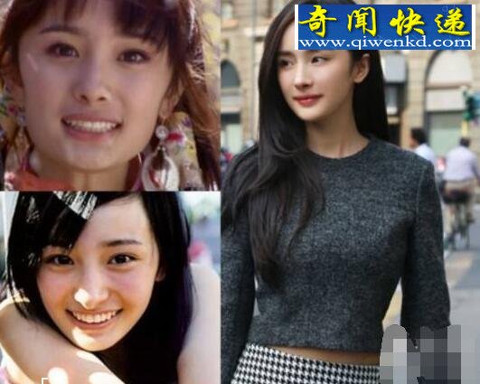 杨幂整容前后照片对比,整张脸都是整出来的(僵硬)