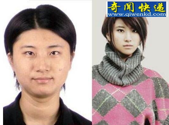 尚雯婕整容前后照片,五官变形成老太婆(不忍直视)