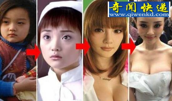 李小璐整容前后对比照曝光,下巴变形面部僵硬