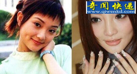 李小璐整容前后对比照曝光,下巴变形面部僵硬