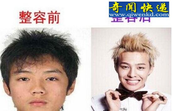 鹿晗整容之前这么丑,网友大呼男神形象幻灭