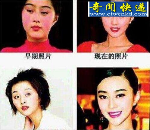 范冰冰整容失败照片曝光,整容前后判若两人