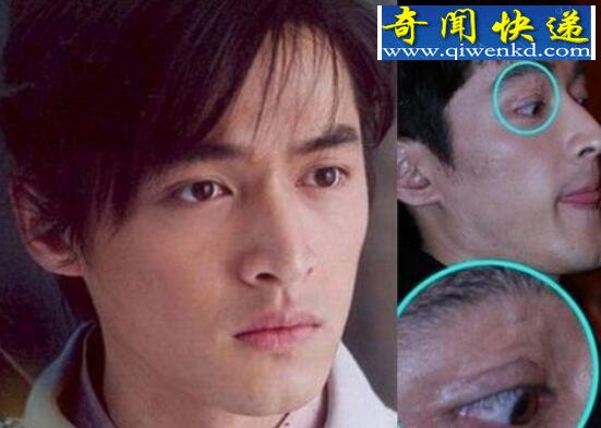 胡歌车祸前后照片对比,胡歌车祸真相大揭秘