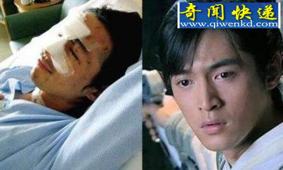 胡歌车祸前后照片对比,胡歌车祸真相大揭秘