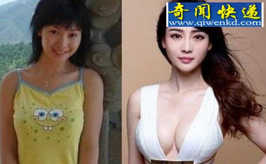 柳岩整容前后照片惊人,柳岩整容事件最终落实