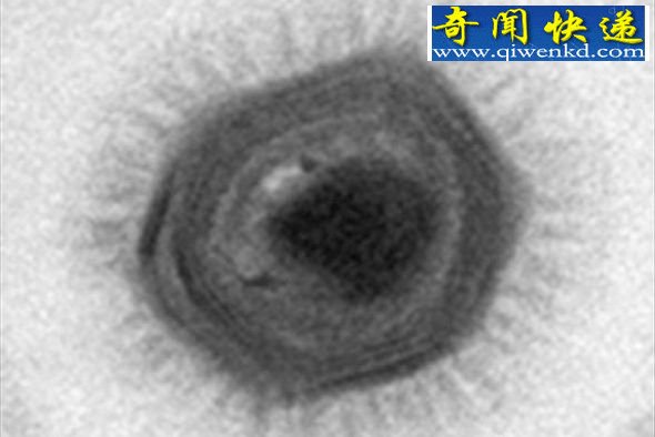 智利海域发现世界最大病毒 智利海域发现世界最大病毒:拥有1000多个基因