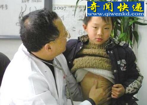 中国首例成功分离连体婴儿,如愿考上大学健康成长