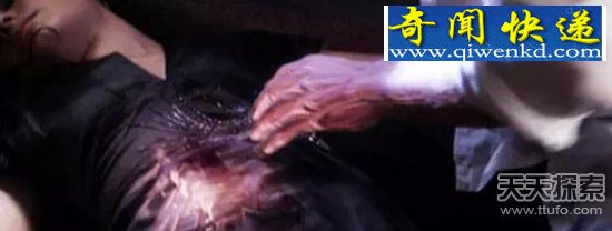 埃及美女长有尾巴 想都不敢想的人体奇闻
