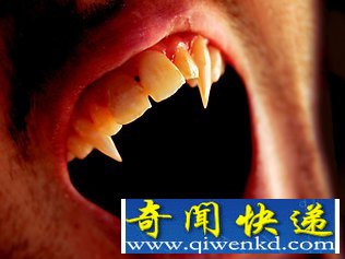 为驱吸血鬼 塞尔维亚小镇大蒜被疯抢