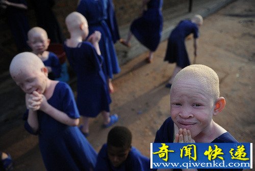 地球上最恐怖吓人的“怪病”