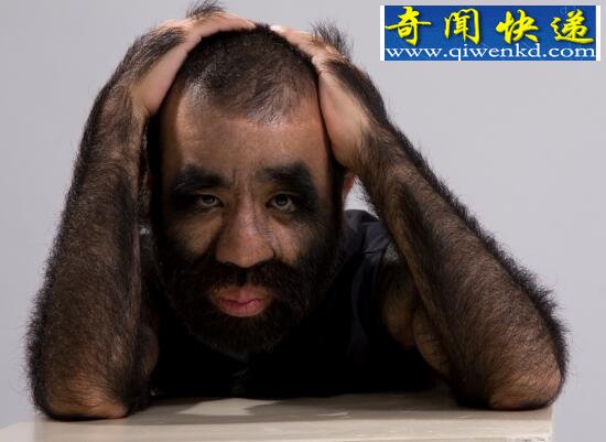 世界毛发覆盖最多的人,于震寰(中国第一毛孩)