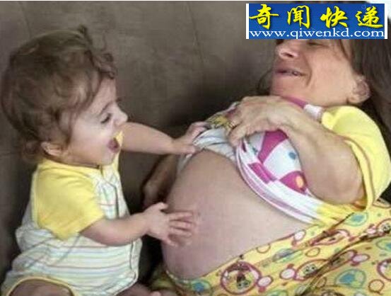 盘点世界十大袖珍人,袖珍人能生育吗