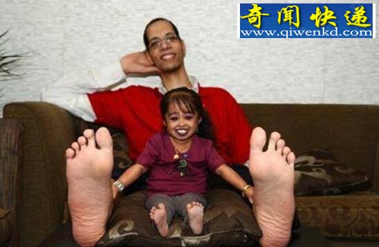盘点世界十大袖珍人,袖珍人能生育吗