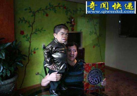 世界最矮的人,能拿公鸡当坐骑(54.6厘米)