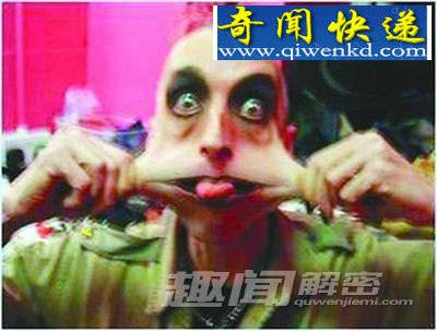 细数全球最恐怖的十大怪病!