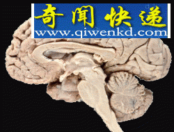研究称大脑可根据搜索目标改变功能 大脑可根据搜索目标改变功能