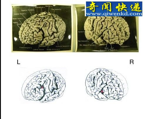 爱因斯坦大脑神经分布密度比普通人更高(图)