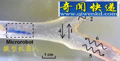 科学家开发微型机器人进入人体血管清除淤积