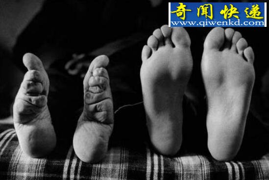 古代妇女缠足图片,三寸金莲其实恶心至极