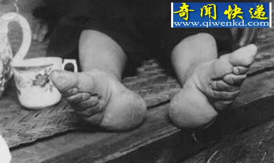古代妇女缠足图片,三寸金莲其实恶心至极