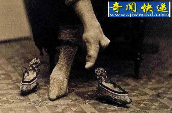 古代妇女缠足图片,三寸金莲其实恶心至极