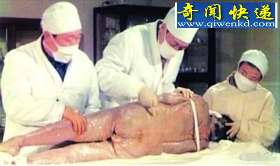 世界上保存最完好的古尸,长沙马王堆汉墓女尸(奇迹)