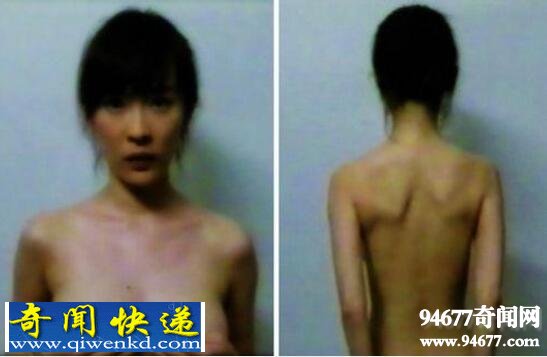 霍思燕的胸那么大竟然是假的,隆了一个下垂的胸